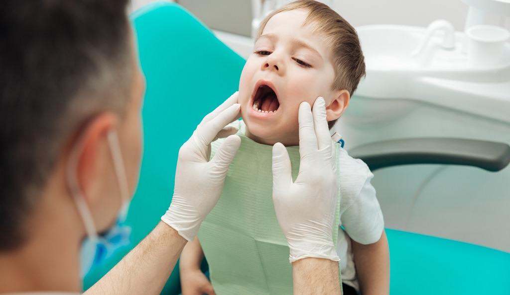 Trẻ em có nên lấy cao răng không? | Cách lấy cao răng cho trẻ em